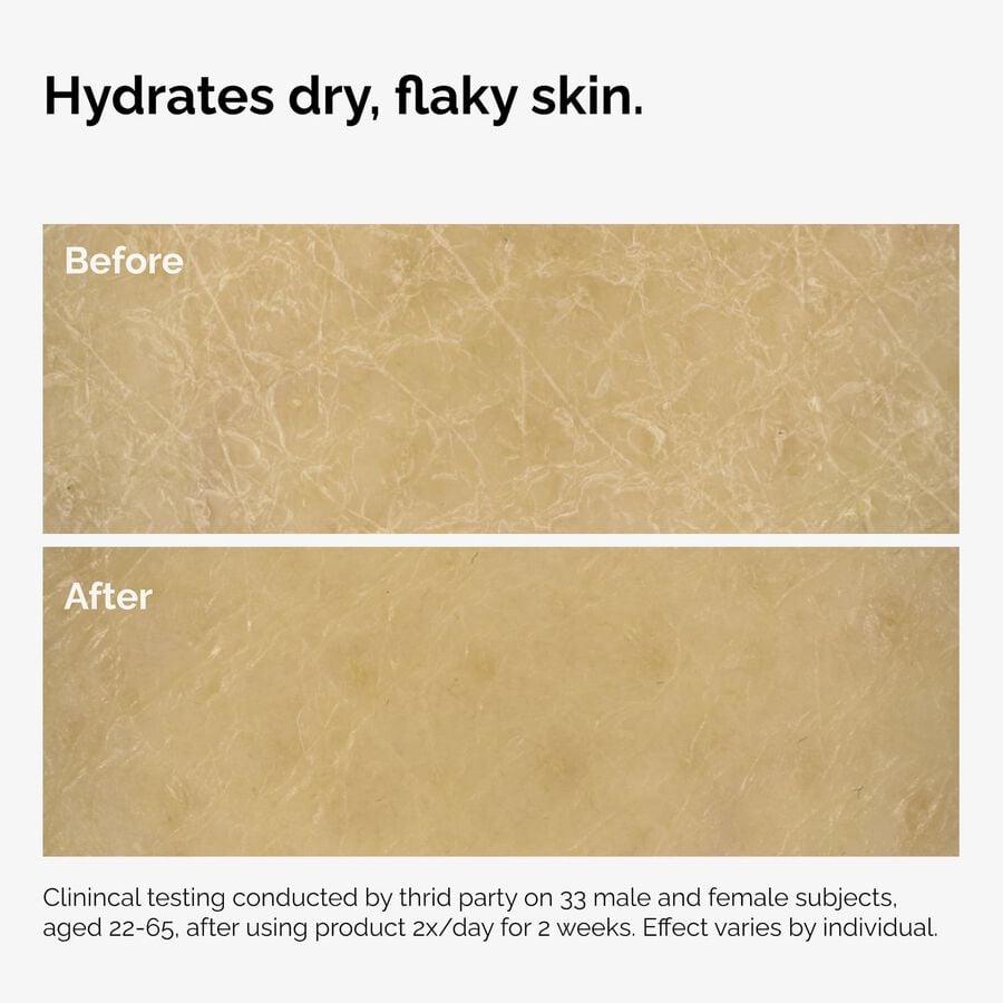 the-body-care-collection-p4 ord-natural-moisturizing-factors-inulin-body-before-after-graphic-02.jpg