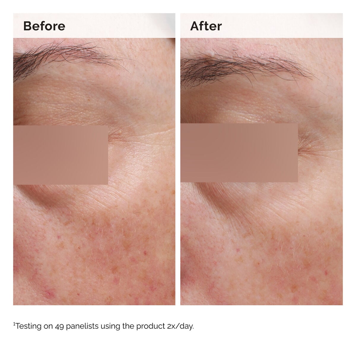 niacinamide-5-face-and-body-emulsion-y8 2024-08-23-ORD-Nia-5pct-Face-Body-B-A-Elasticity-Global-02-1x1.jpg